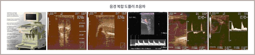음경 복합 도플러 초음파. 초음파 장비 사진과 음경 혈류를 촬영한 초음파 영상 다섯 장