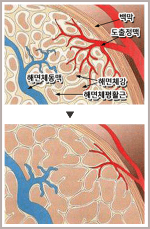 백막·도출정맥·해면체동맥·해면체강·해면체평활근을 표시한 해면체 단면도와, 해면체강에 혈류가 찬 모습을 위아래로 비교한 그림