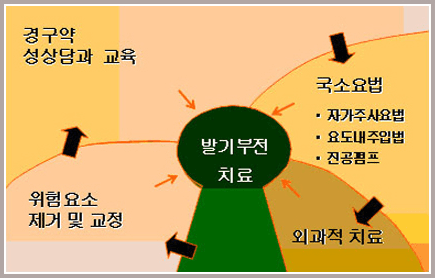 발기부전 치료를 가운데 두고 경구약·성상담과 교육, 국소요법(자가주사요법·요도내주입법·진공펌프), 외과적 치료, 위험 요소 제거 및 교정이 둘러싼 도식