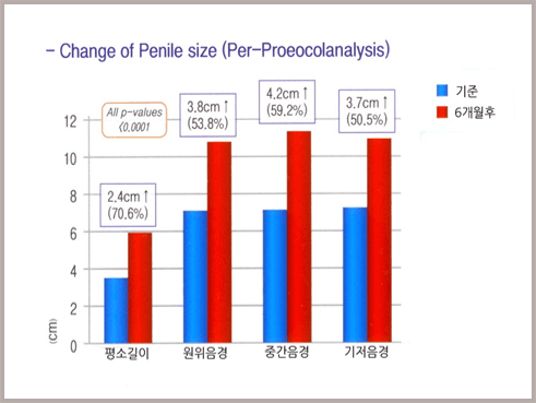 시술 전후 음경 크기 변화 막대그래프(Change of Penile size). 기준 대비 6개월 후 평소길이 2.4cm(70.6%), 원위음경 3.8cm(53.8%), 중간음경 4.2cm(59.2%), 기저음경 3.7cm(50.5%) 증가, All p-values <0.0001